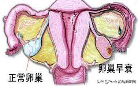 怀孕几天能去香港验血贵吗,备孕熬夜会很难怀孕吗