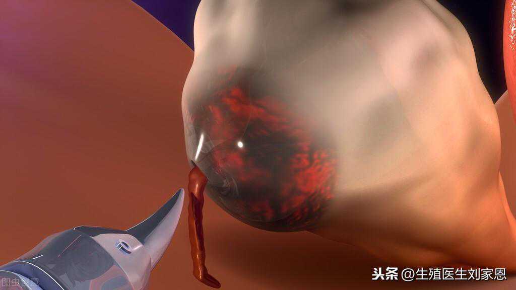 香港验血最早几天,48岁大龄绝经，做供卵试管婴儿的成功率有多高？
