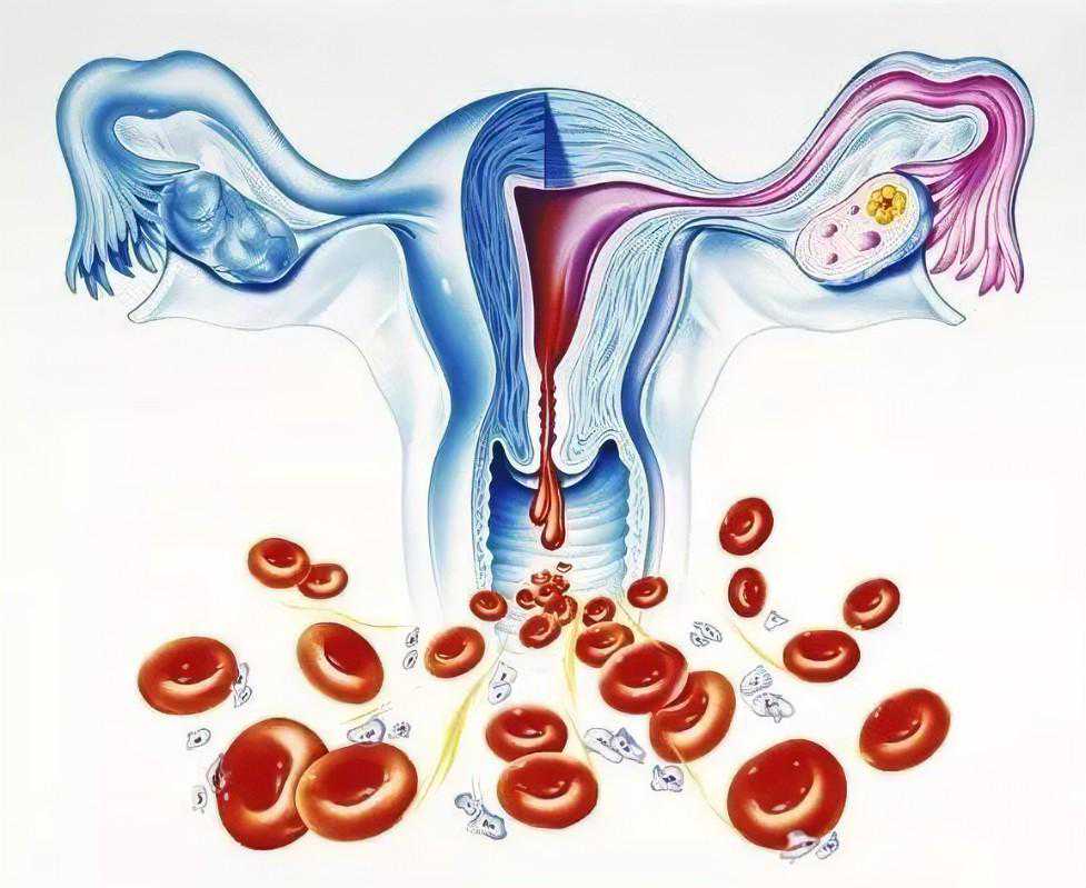 香港验血2次b超结果不同信哪个,月经期是排卵期会不孕吗