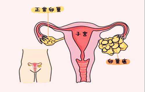 到香港验血男孩女孩怀孕多久才能验出,不知不觉就怀不上了？附最全男女不孕