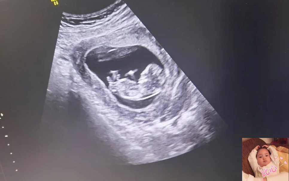 香港验血预约网站,2022年生虎宝宝备孕时间表 2022年虎宝宝几月出生好